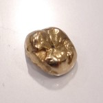 金歯